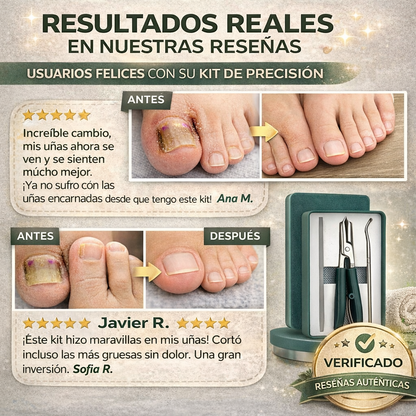 Kit Cortex Pro - ¡Adiós uñas encarnadas hoy!