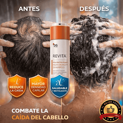 REVITA- DETIENE LA CAIDA DEL CABELLO