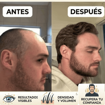 Serum Capilar® Frena la Caída y Gana Volumen 2x1 + Guía de Cuidado Capilar GRATIS