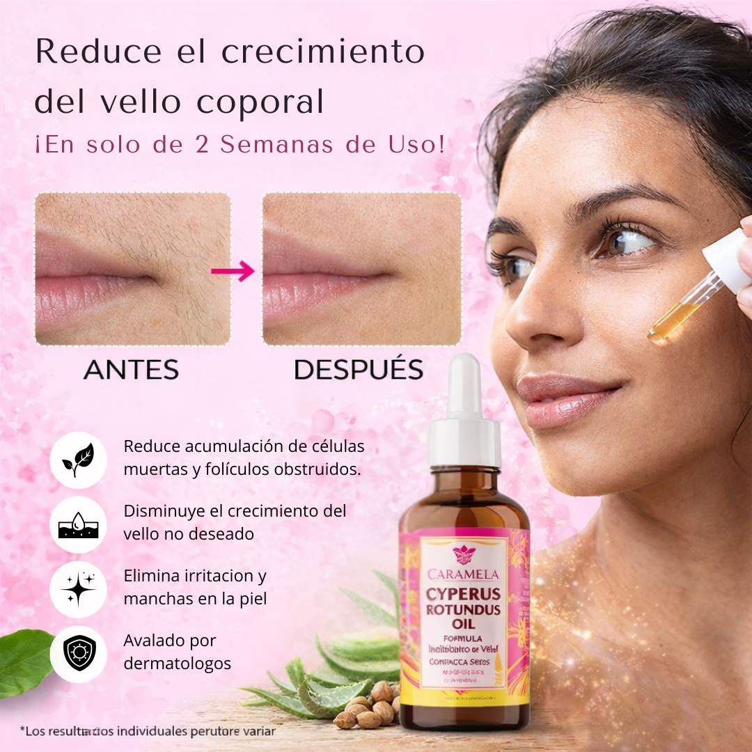 Cyperus Rotundus Oil 30ml - ¡Reduce crecimiento de vello sin irritaciones!