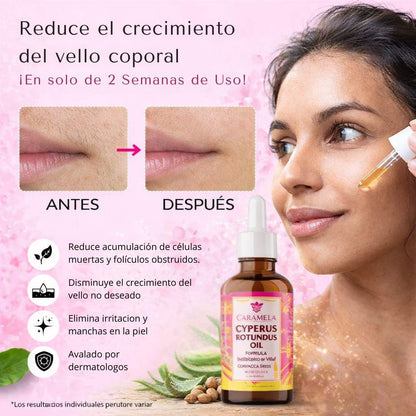 Cyperus Rotundus Oil 30ml - ¡Reduce crecimiento de vello sin irritaciones!