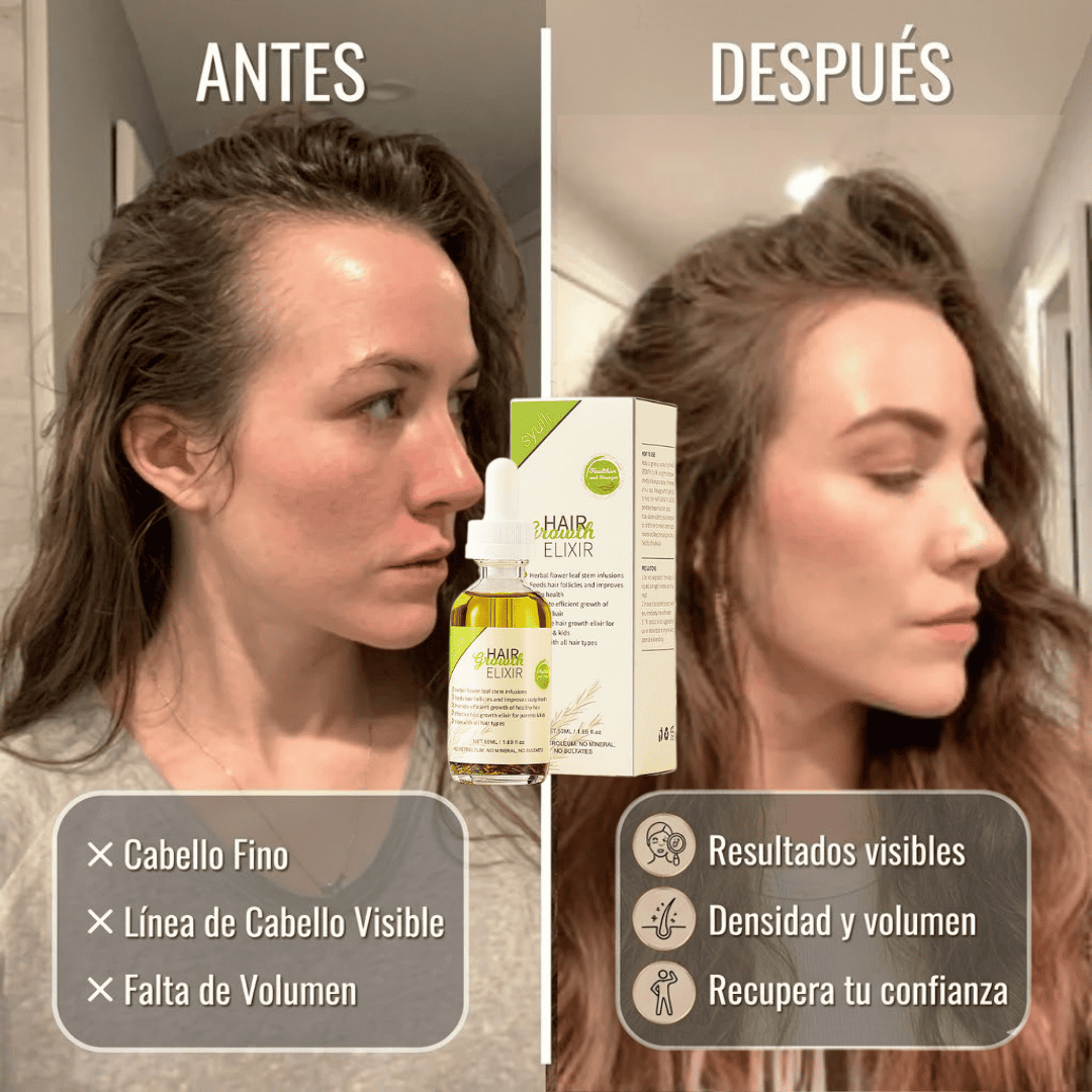 Serum Capilar Girl® Frena la Caída y Gana Volumen + Guía de Cuidado Capilar GRATIS
